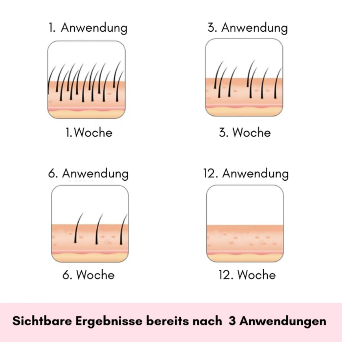 Diagramm des Haarwuchses über 12 Wochen, sichtbare Ergebnisse.