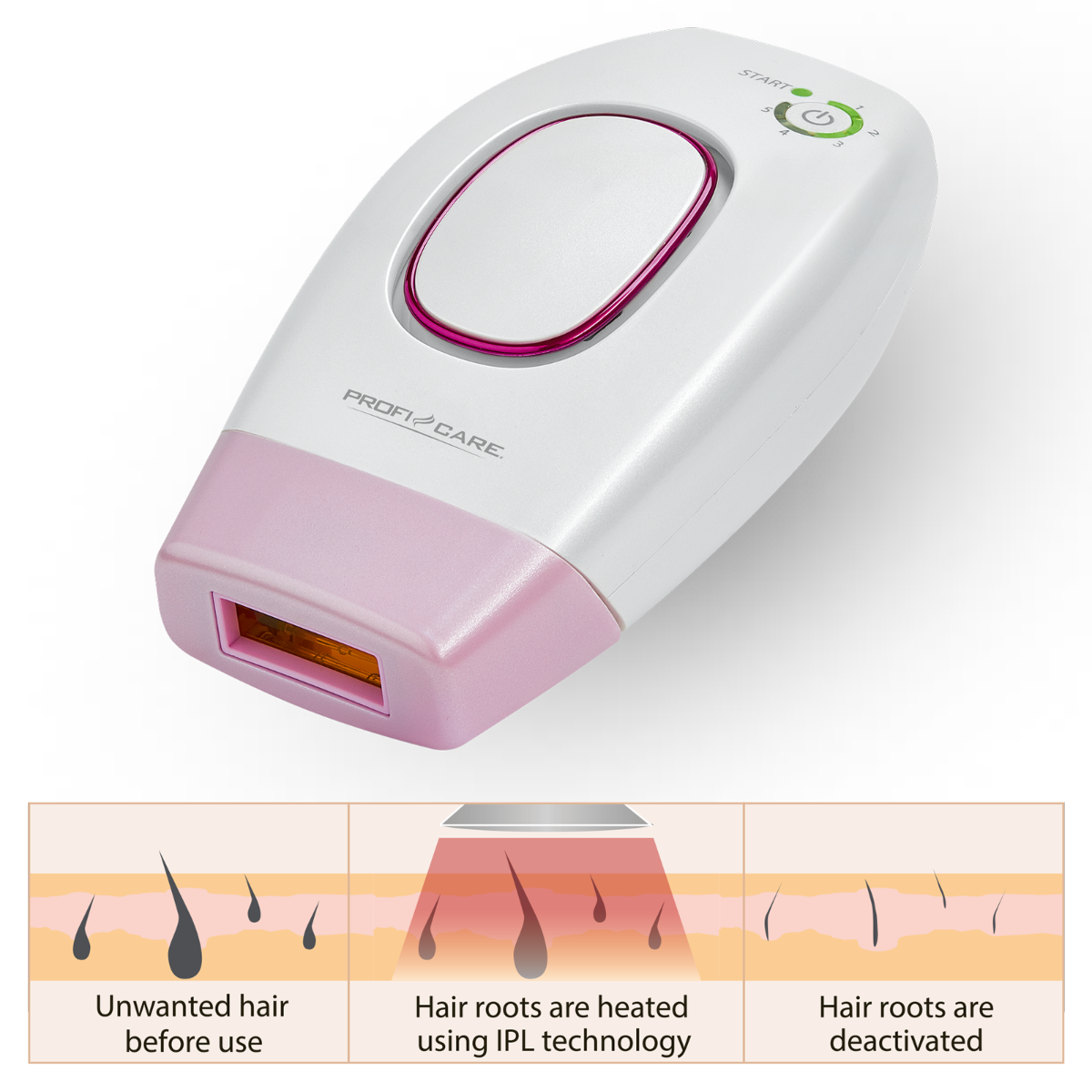 Białe i różowe urządzenie do depilacji IPL z diagramem zabiegu na mieszku włosowym.