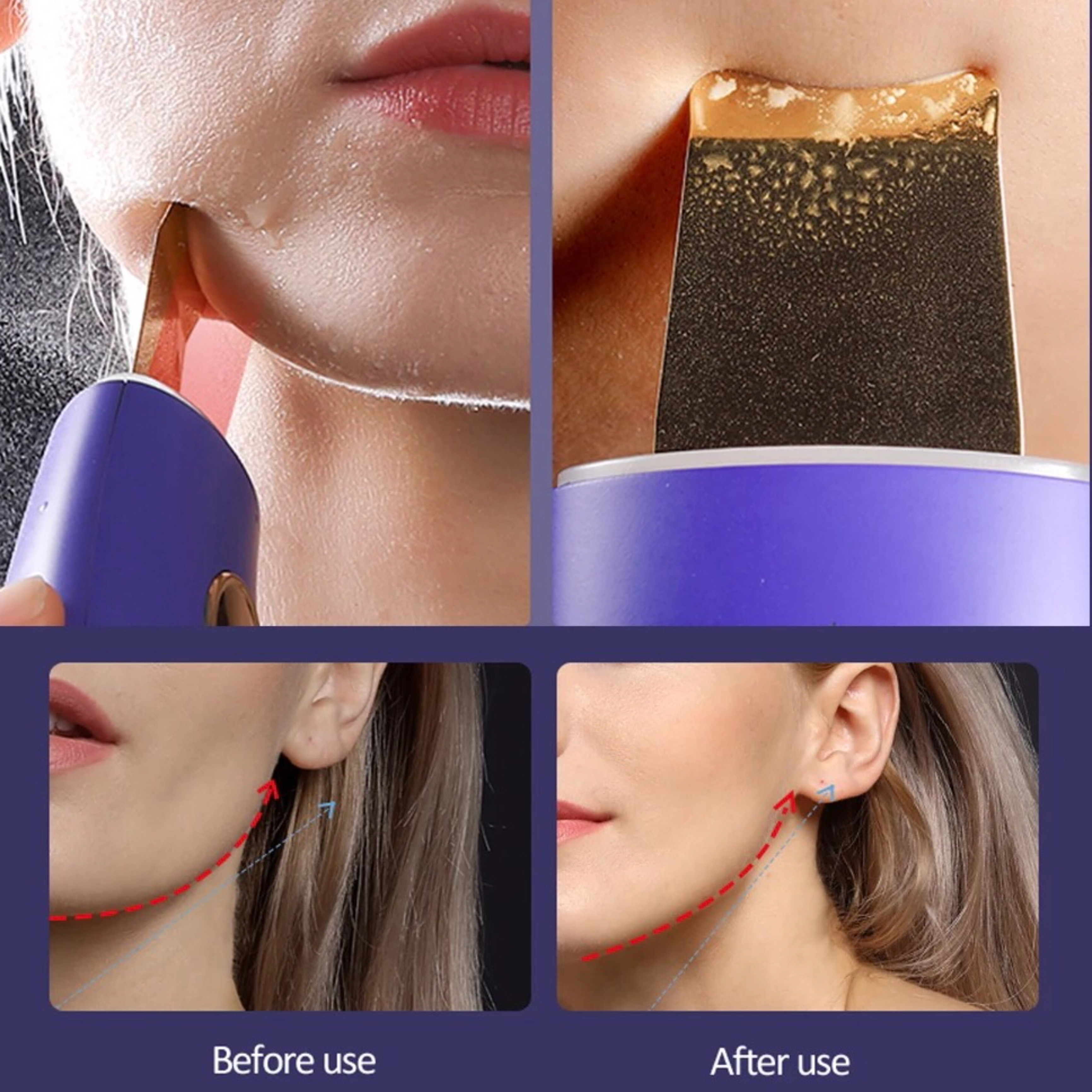 Zbliżenie na twarz kobiety podczas zabiegu pielęgnacji skóry.