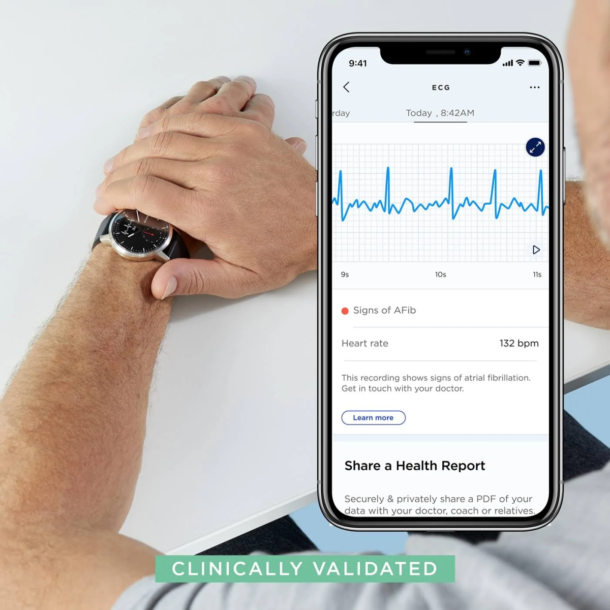 Person überprüft Herzfrequenz auf Smartwatch mit EKG. Uhr zeigt Vorhofflimmern.