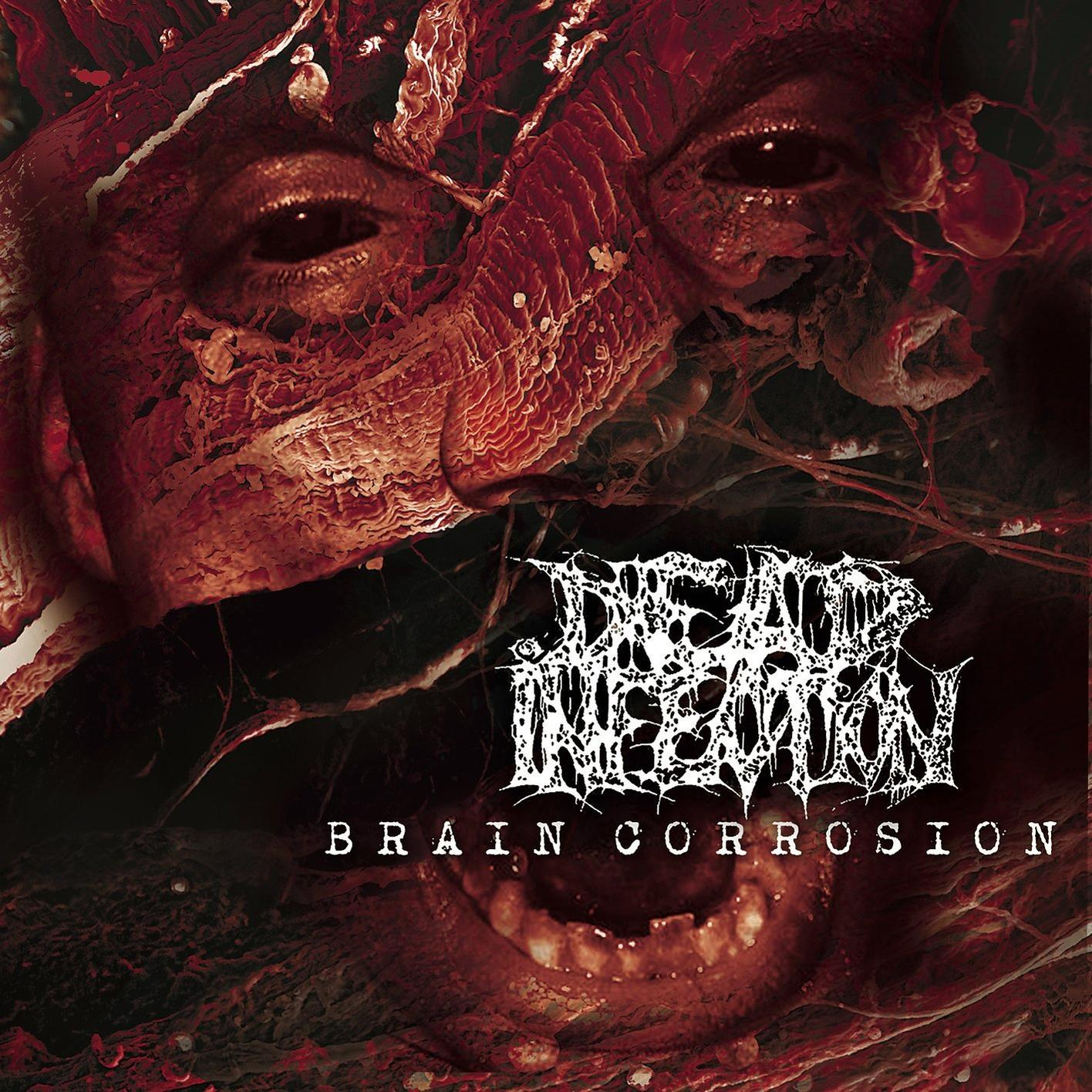 Infection (Vinyl) Corrosion - LP) Brain - (Vinyl Dead