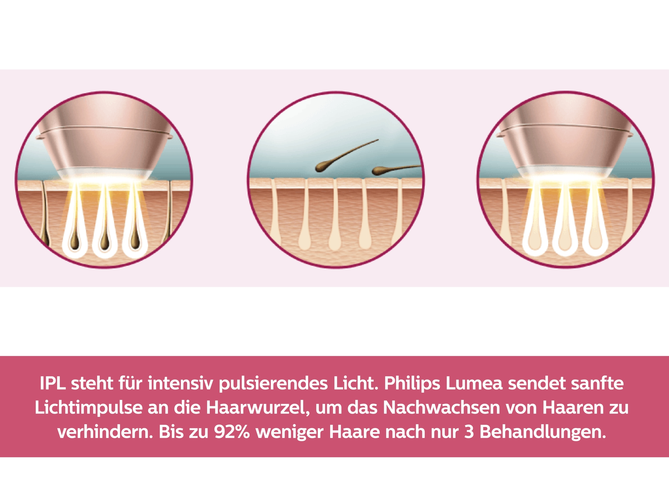 PHILIPS Lumea Prestige IPL-Haarentfernungsgerät BRI956/00, weiß-rosegold IPL-Haarentfernungsgerät (weiß, roségold, mit , )