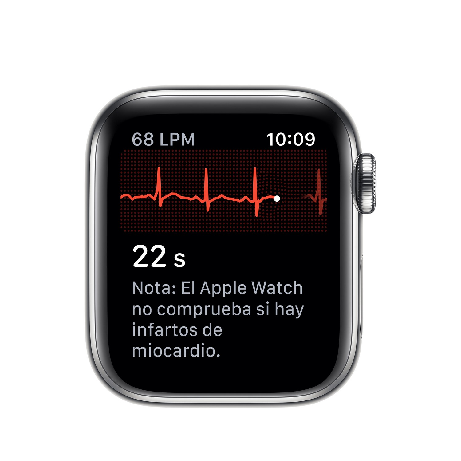 Apple Watch mostrando una lectura de ECG con texto en español.
